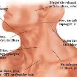 Lymfatické uzliny zduření Dr Popov