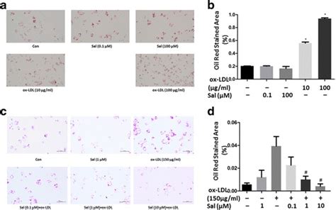 Salidroside Protects Against Foam Cell Formation And Apoptosis