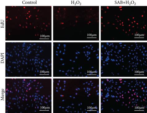 Sab Promoted Proliferation Of Npcs Reduced By H2o2in Vitro Via