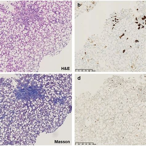 General Histological Findings Hematoxylin And Eosin Hande Staining