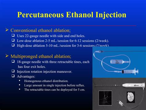 Ablation Of Hcc Ppt