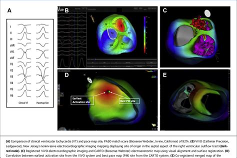 Figure From A Novel Use Of Noninvasive Registered