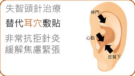 中醫師談失智症 頭皮針治療 Ettoday探索 Ettoday新聞雲