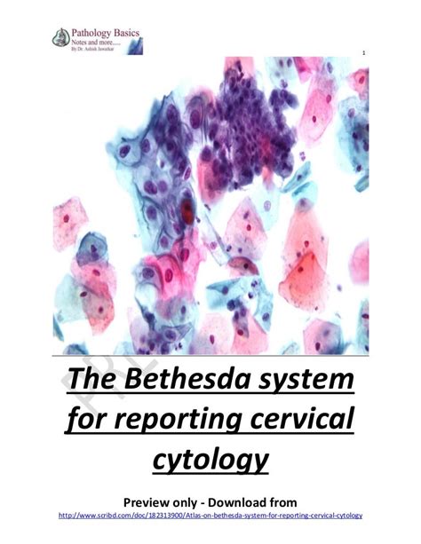 Atlas On Bethesda System For Reporting Cervical Cytology