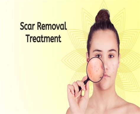 Acne Scar Removal – Tvak Laser Clinic