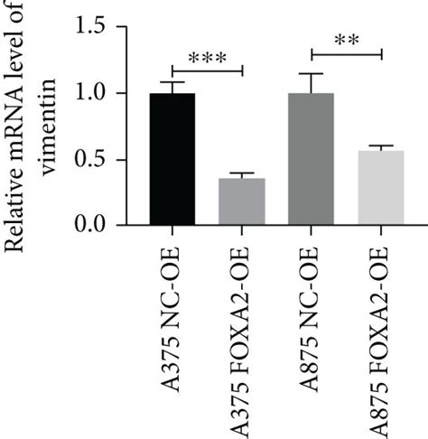 FOXA2 Inhibits Melanoma Cell Migration And Invasion In Vitro A B