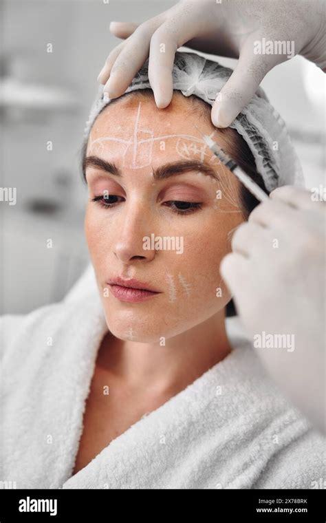 Botulinum Therapy Correction Of Mimic Wrinkles Stock Photo Alamy