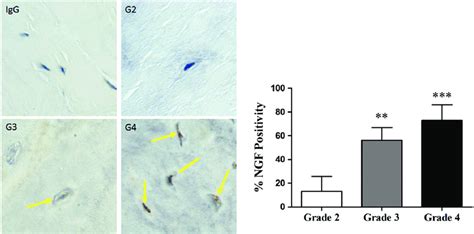 Expression Of Nerve Growth Factor Ngf By Immunohistochemistry In