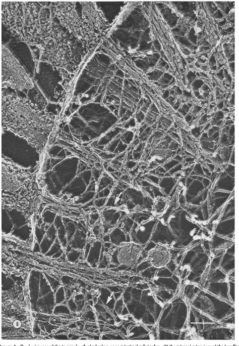 Figure 8 From Quick Freeze Deep Etch Visualization Of The Cytoskeleton