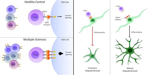 Oligodendrocytes Multiple Sclerosis