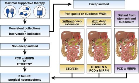 Current Concepts In Severe Acute And Necrotizing Pancreatitis An Evidence Based Approach