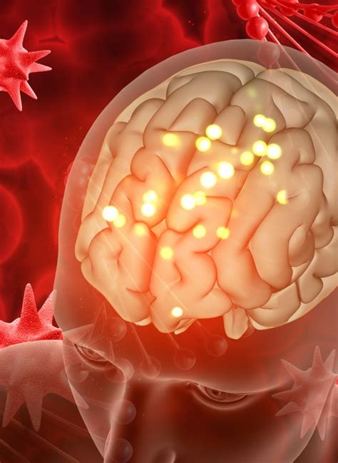 Sclerosi Multipla E Cellule Staminali Conservazione Cellule Staminali