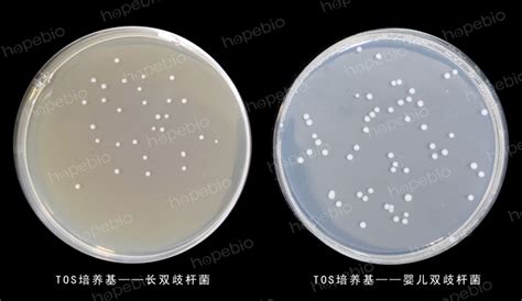 Tos培养基 微生物图片 青岛海博生物