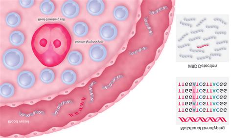 Circulating Tumor Dna In Hodgkin Lymphoma This Figure Shows An Example