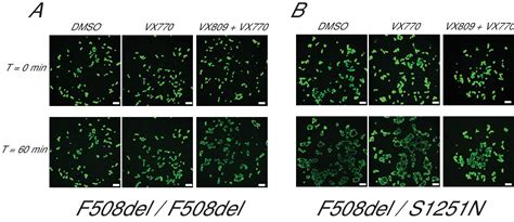 Forskolin Induced Swelling In Intestinal Organoids An In Vitro Assay