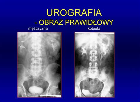 Diagnostyka układu moczowego przestrzeni zaotrzewnowej i narządu