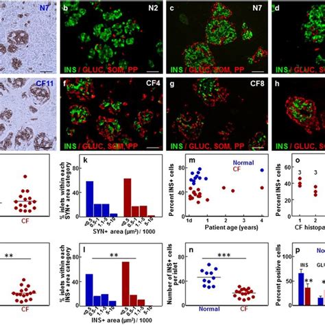 Inflammatory Cell Infiltrates In Islets And Extra Islet Tissue In The Download Scientific