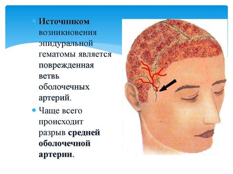 Черепно–мозговая травма - презентация онлайн