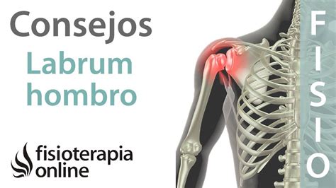 Consejos para solucionar la lesión labrum de hombro SLAP