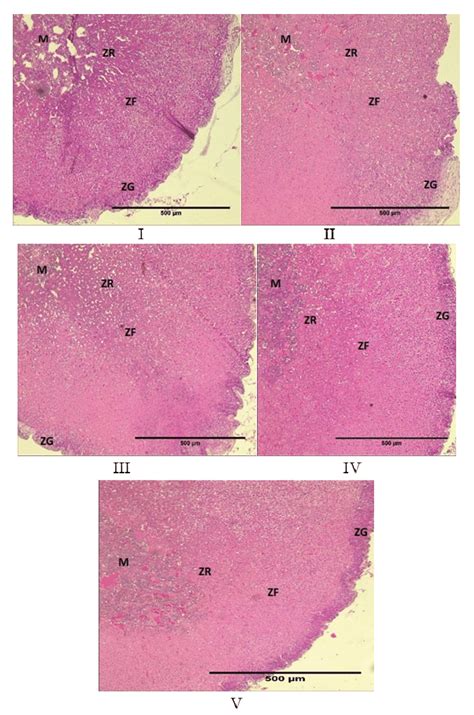 Adrenal Gland Histology Labeled