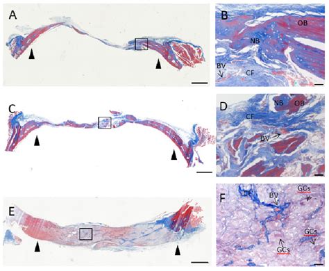 Representative Photomicrographs Obtained At 90 Days Postoperative