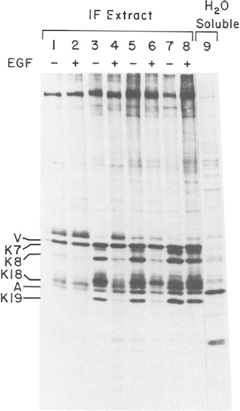 Figure 2 From Regulation Of Human Mesothelial Cell Differentiation