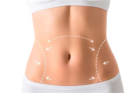 Abdominoplastia Em Valor Quanto Custa Em Vit Ria Es Dr Jorge