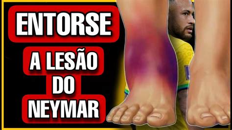 Entenda A Les O Do Neymar Entorse Do Tornozelo Youtube