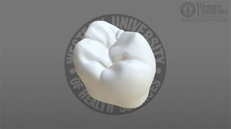 300025 Maxillary 2nd Molar 3d Model By Westernu3d [5aa5cf6] Sketchfab