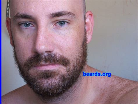 California Anthony Beards Org Beard Galleries