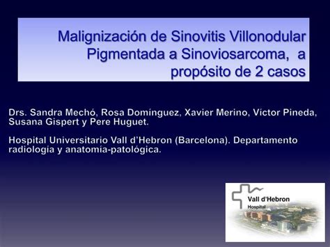 Ppt Malignizaci N De Sinovitis Villonodular Pigmentada A