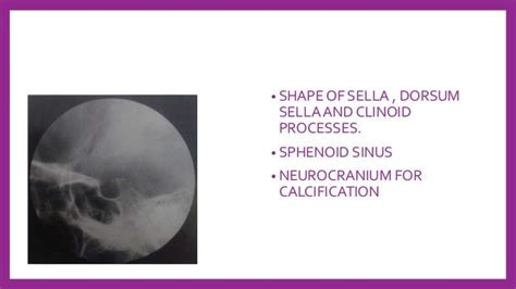 Skull Radiography Techniques And Reporting