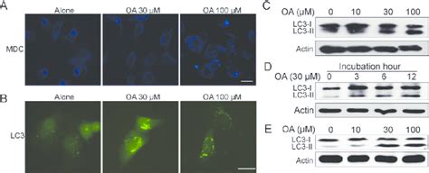 Oleanolic Acid Induced Evident Autophagy In HepG2 Cells A HepG2