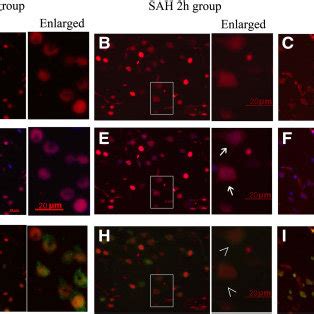 Representative Immunohistochemistry Analysis Of High Mobility Group Box