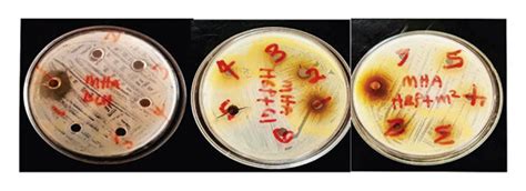 Zone Of Inhibition Of Honey On Staphylococcus Aureus Download