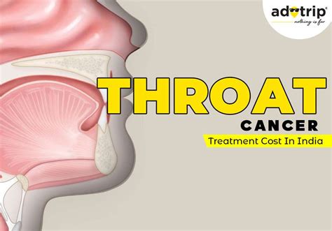 Throat Cancer Treatment cost in India | Adotrip