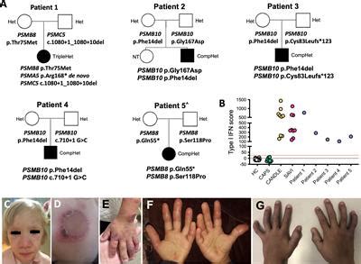 Frontiers Identification Of Eight Novel Proteasome Variants In Five