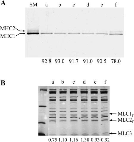 Myosin Heavy And Light Chain Mhc And Mlc Isoforms Determined By