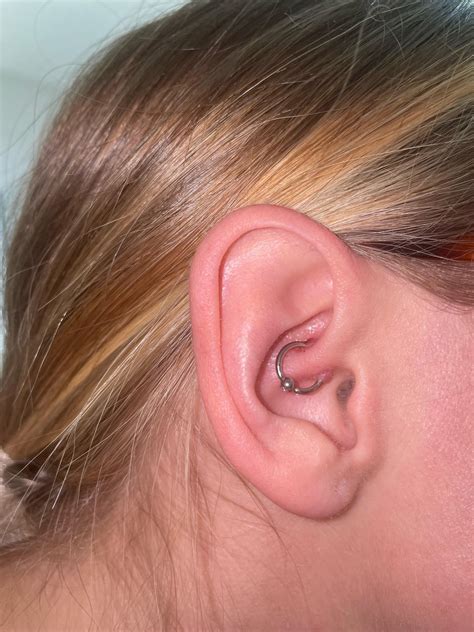 Daith Piercing Not Healing After Almost 4 Months Rpiercing