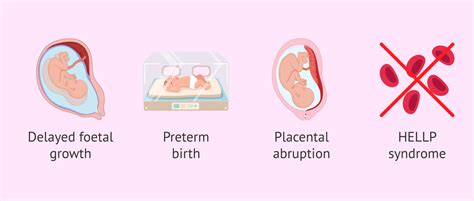 What are the possible complications of pre-eclampsia?