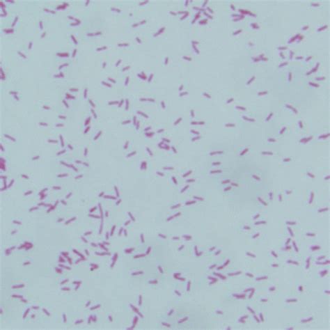 Bordetella Pertussis Gram Stain