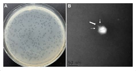 Morphology Of The Phage Plaque And Negative Stained Phage Virions