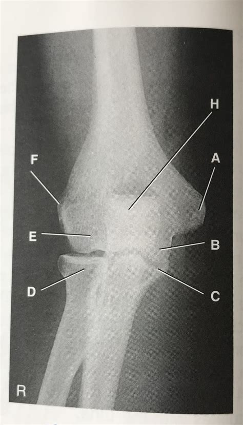 AP Elbow Diagram Quizlet