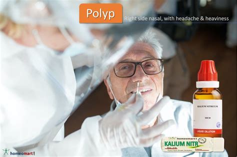 Best Homeopathic Medicines For Nasal Polyps Safe And Effective