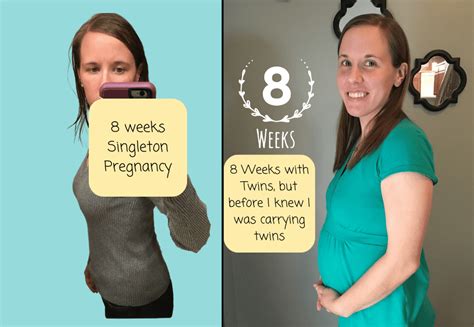 16 Weeks Pregnant With Twins Belly