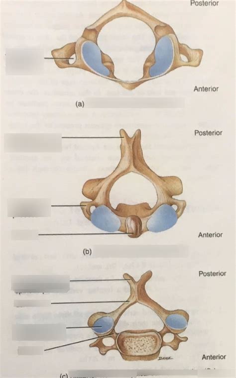 E Atlas Axis And Cervical Vertebrae Labeling Colored Diagram