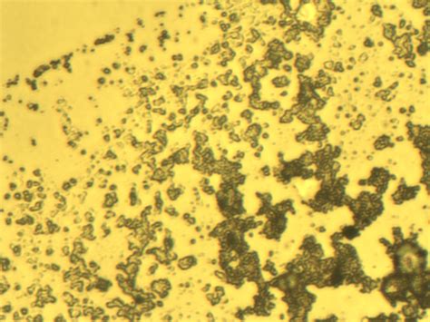 My neural cells are die in the culture, what went wrong? | ResearchGate 