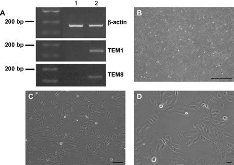 Td Ec Detection And Cell Morphology Notes A TeM1 And TeM 8 Gene