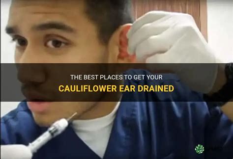 The Best Places To Get Your Cauliflower Ear Drained Shuncy