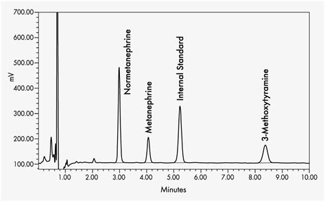 Metanephrines in Urine/Combined analysis - HPLC